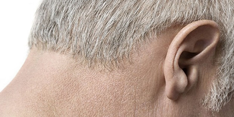 Can What You Eat Cause Excessive Earwax?
